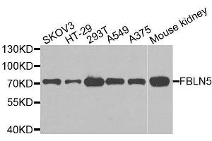 Western blot analysis of extracts of various cell lines, using FBLN5 antibody (ABIN6003669) at 1/1000 dilution. (Fibulin 5 antibody)