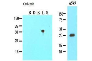 The recombinant fusion proteins (Cathepsin B, D, k, L and S), and cell lysates of A549 (20 ug) were resolved by SDS-PAGE, transferred to nitrocellulose membrane and probed with anti-human Cathepsin L (1:1000). (Cathepsin L antibody  (AA 114-333))