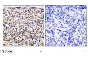 Image no. 1 for anti-cAMP Responsive Element Binding Protein 1 (CREB1) (Ser129) antibody (ABIN197535) (CREB1 antibody  (Ser129))