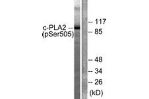 Western blot analysis of extracts from HeLa cells treated with TNF-a 20ng/ml 30', using c-PLA2 (Phospho-Ser505) Antibody. (C-PLA2 (AA 471-520), (pSer505) antibody)