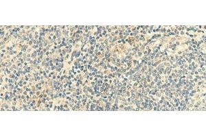 Immunohistochemistry of paraffin-embedded Human tonsil tissue using CLEC10A Polyclonal Antibody at dilution of 1:50(x200) (CLEC10A antibody)