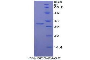 SDS-PAGE analysis of Human Mindbomb Homolog 1 Protein. (MIB1 Protein)
