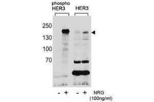 Western blot analysis of extracts from T47D cells, untreated or treated with NRG, using phospho-HER3 antibody (left) or nonphos Ab (right). (ERBB3 antibody  (pTyr1289))