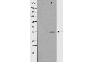 Western blot analysis of extracts of mouse brain line, using DKK3 antibody.