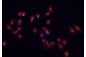 ABIN6266901 staining MCF-7 cells by IF/ICC. (FHIT antibody  (Internal Region))