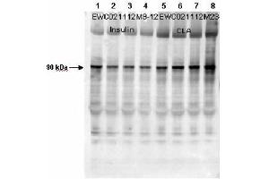 Affinity Purified Phospho-specific antibody to human muscle Glycogen Synthase (GS) at pS640 was used at a 1:1000 dilution to detect human muscle GS by Western blot.