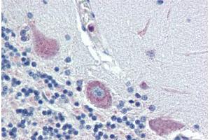 Brain, cerebellum, Human: Formalin-Fixed, Paraffin-Embedded (FFPE) (TGFB3 antibody  (C-Term))