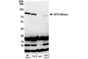 Western Blotting (WB) image for anti-Eukaryotic Elongation Factor-2 Kinase (EEF2K) (AA 675-725) antibody (ABIN7454537) (EEF2K antibody  (AA 675-725))