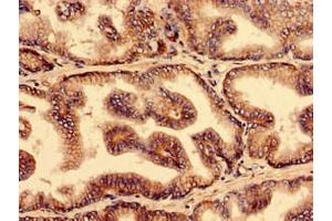 Immunohistochemistry analysis of human prostate tissue using ABIN7166334 at dilution of 1:100 (YIF1B antibody  (AA 1-153))