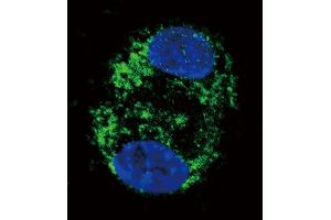 Confocal immunofluorescent analysis of CPT2 Antibody with HepG2 cell followed by Alexa Fluor 488-conjugated goat anti-rabbit lgG (green). (CPT2 antibody  (C-Term))