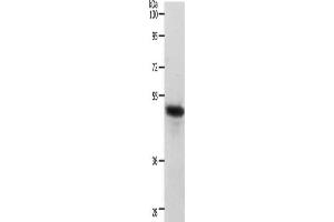Gel: 10 % SDS-PAGE, Lysate: 40 μg, Lane: Human liver cancer tissue, Primary antibody: ABIN7190220(CERS2 Antibody) at dilution 1/750, Secondary antibody: Goat anti rabbit IgG at 1/8000 dilution, Exposure time: 40 seconds (Ceramide Synthase 2 antibody)