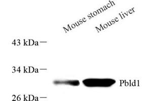 Western blot analysis of PBLD (ABIN7075030),at dilution of 1: 2000 (PBLD1 antibody)