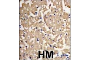 Forlin-fixed and paraffin-embedded heart muscle tissue reacted with Autophagy LC3 G8a (M1LC3A) Antibody (P45) 1801b , which was peroxidase-conjugated to the secondary antibody, followed by DAB staining. (MAP1LC3A antibody  (AA 30-56))