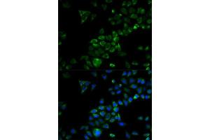Immunofluorescence analysis of HeLa cells using TRAF3 antibody. (TRAF3 antibody)