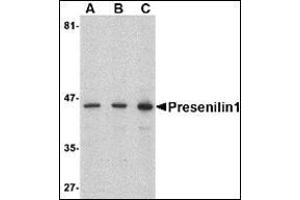 Western blot analysis of presenilin1 in human brain lysate with this product at (A) 0. (Presenilin 1 antibody  (C-Term))