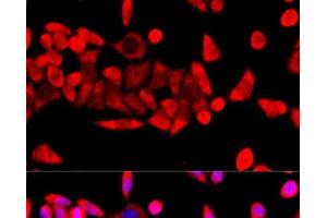 Immunofluorescence analysis of HeLa cells using RPL8 Polyclonal Antibody at dilution of 1:100 (40x lens). (RPL8 antibody)