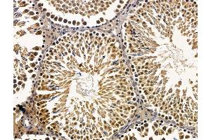 ABIN7096468 and ABIN7100532 at 1/100 staining rat testis tissue by IHC-P. (Znf423 antibody)
