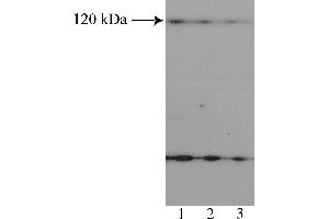 Western Blotting (WB) image for anti-Nuclear Factor of Activated T-Cells, Cytoplasmic, Calcineurin-Dependent 2 (NFAT1) (AA 433-567) antibody (ABIN967558) (NFAT1 antibody  (AA 433-567))