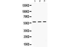 Western blot analysis of XIAP expression in rat kidney extract ( Lane 1), mouse liver extract ( Lane 2) and HELA whole cell lysates ( Lane 3).