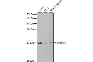 使用SH2D1A抗体（ABIN3021535、ABIN3021556、ABIN2021537和ABIN6215210）在1:1000稀释度下对各种细胞系提取物进行Western blot分析。（SH2D1A抗体（AA 1-128））