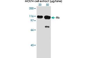 Western blot analysis of in extracts from MOLT 4 cell using RB1 (phospho S807) monoclonal antibody, clone 5H12 .