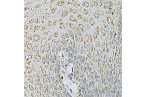Immunohistochemistry (Paraffin-embedded Sections) (IHC (p)) image for anti-Adaptor-Related Protein Complex 2, beta 1 Subunit (AP2B1) (AA 752-951) antibody (ABIN3015810)