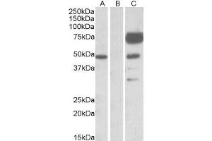 HEK293 lysate (10ug protein in RIPA buffer) overexpressing Human ANGPT1 with DYKDDDDK tag probed with ABIN2561113 (1ug/ml) in Lane A and probed with anti- DYKDDDDK Tag (1/1000) in lane C. (Angiopoietin 1 antibody  (Internal Region))
