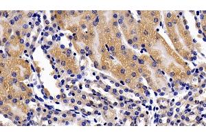 Immunohistochemistry (IHC) image for anti-Tumor Necrosis Factor Receptor Superfamily, Member 1A (TNFRSF1A) (AA 239-433) antibody (ABIN7437260)