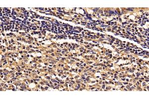 Detection of IL2Rg in Human Appendix Tissue using Polyclonal Antibody to Interleukin 2 Receptor Gamma (IL2Rg) (IL2RG antibody  (AA 23-262))
