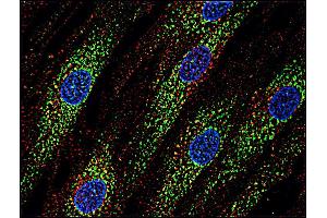 Immunofluorescence staining of human skin fibroblasts with anti-CD63 (MEM-259 ; green) after co-incubation of living cells with human Transferrin - Dyomics 547; cell nuclei stained with DAPI (blue). (CD63 antibody  (FITC))