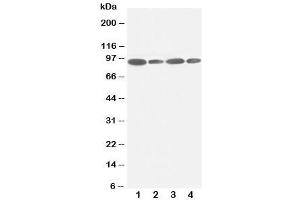 Western blot testing of FES antibody and Lane 1:  HeLa (FES antibody  (C-Term))