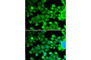 Immunofluorescence analysis of MCF-7 cells using RPS10 antibody (ABIN1877083).