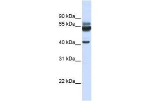 PARD6B antibody used at 1 ug/ml to detect target protein.
