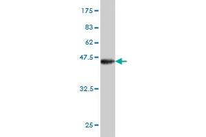 Western Blot detection against Immunogen (40. (BRD3 antibody  (AA 418-556))