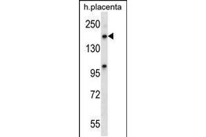 Western blot analysis in human placenta tissue lysates (35ug/lane). (XPO5 antibody  (C-Term))