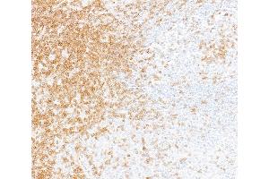 Immunohistochemistry (IHC) image for anti-CD247 Molecule (CD247) (C-Term) antibody (ABIN7454039)