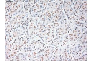 Immunohistochemical staining of paraffin-embedded lung tissue using anti-USP13mouse monoclonal antibody.