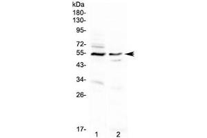 Western blot testing of human 1) A431 and 2) PANC-1 cell lysate with VIPR1 antibody. (VIPR1 antibody)