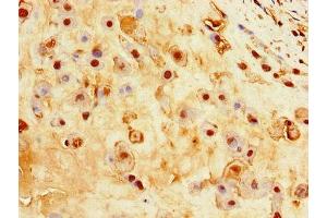 Immunohistochemistry of paraffin-embedded human placenta tissue using ABIN7156880 at dilution of 1:100 (EBI3 antibody  (AA 21-227))