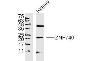 ZNF740 lysates probed with Polyclonal Antibody, unconjugated  at 1:300 overnight at 4°C followed by a conjugated secondary antibody at 1:10000 for 90 minutes at 37°C. (ZNF740 antibody  (AA 101-193))