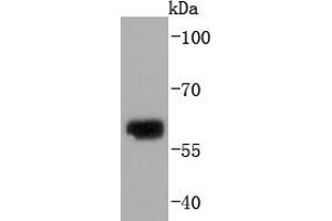 Human skin ysates probed with Collagen X (1H8) Monoclonal Antibody  at 1:1000 overnight at 4˚C. (COL10 antibody)