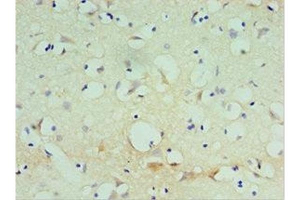 SPAG16 antibody  (AA 1-183)