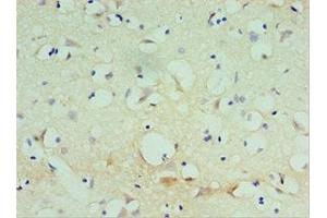 Immunohistochemistry of paraffin-embedded human brain tissue using ABIN7170476 at dilution of 1:100 (SPAG16 antibody  (AA 1-183))