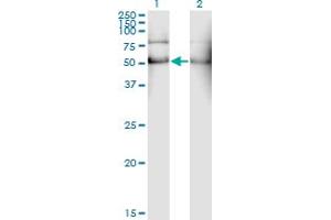Western Blot analysis of ALDH2 expression in transfected 293T cell line by ALDH2 monoclonal antibody (M01), clone 1E5. (ALDH2 antibody  (AA 408-517))