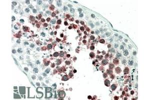 ABIN238571 (5µg/ml) staining of paraffin embedded Human Testis. (MEPCE antibody  (Internal Region))