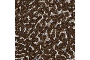 Immunohistochemical staining of human liver with FLII polyclonal antibody  shows strong cytoplasmic positivity in hepatocytes at 1:50-1:200 dilution. (FLII antibody)