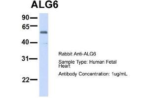 Western Blotting (WB) image for anti-Asparagine-Linked Glycosylation 6, alpha-1,3-Glucosyltransferase Homolog (ALG6) (N-Term) antibody (ABIN2782789)