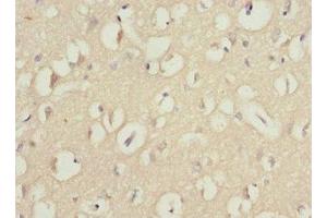 Immunohistochemistry (IHC) image for anti-Wingless-Type MMTV Integration Site Family, Member 7B (WNT7B) (AA 120-349) antibody (ABIN7166313)