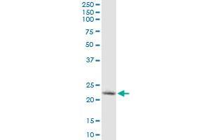 YKT6 monoclonal antibody (M03), clone 1F8. (YKT6 antibody  (AA 99-198))