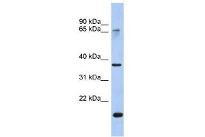 WB Suggested Anti-ANXA10 Antibody Titration:  0. (Annexin a10 antibody  (Middle Region))